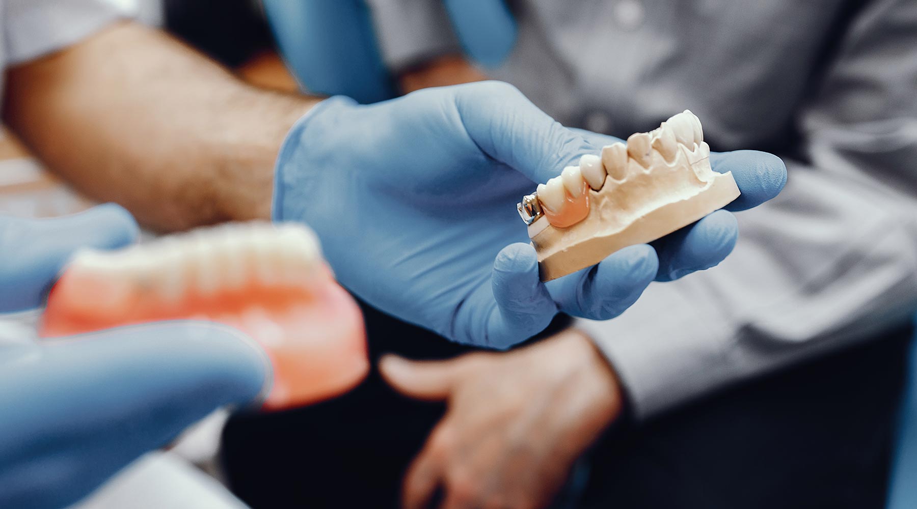 How to find a good private denture technician