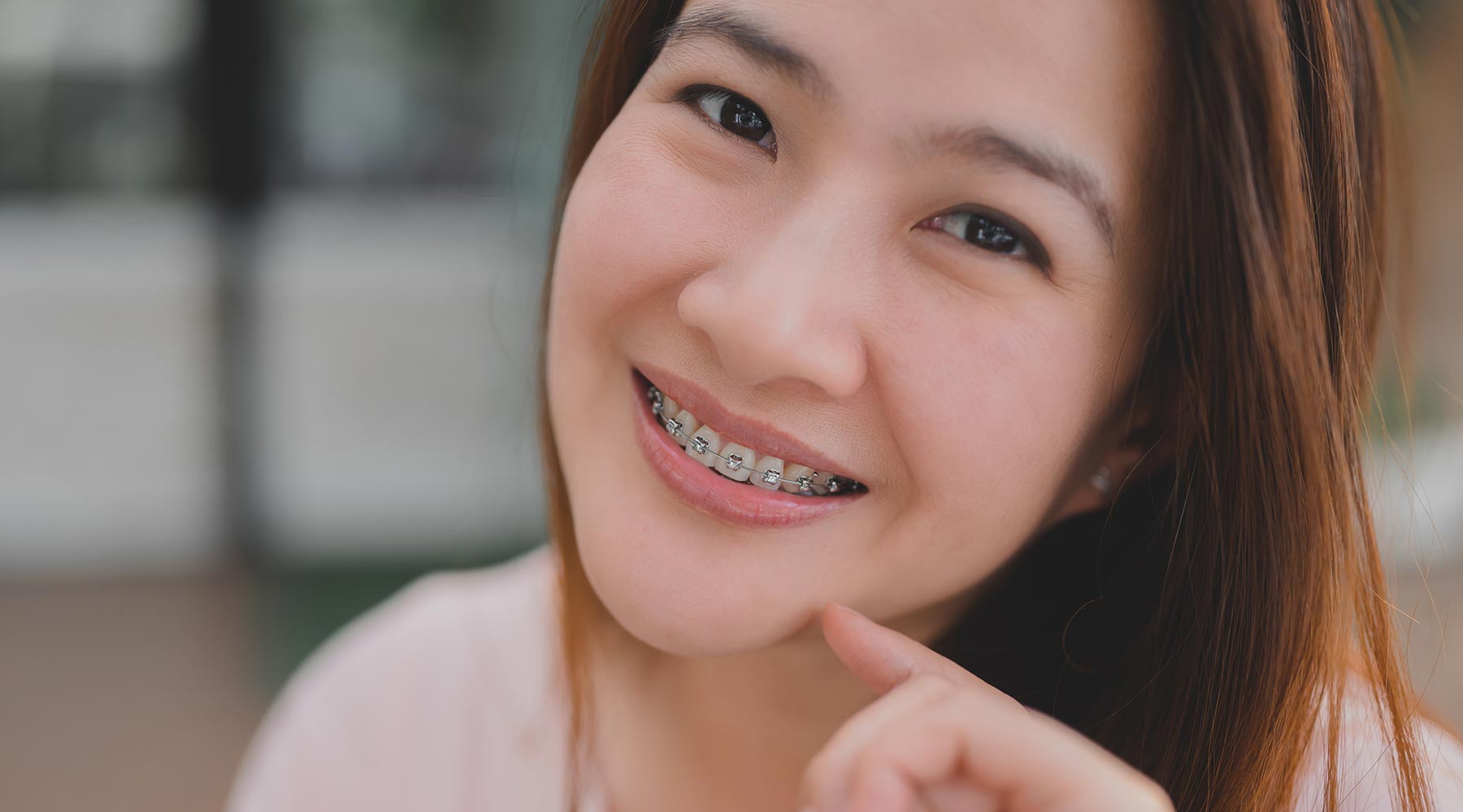 Permanent retainer costs after braces