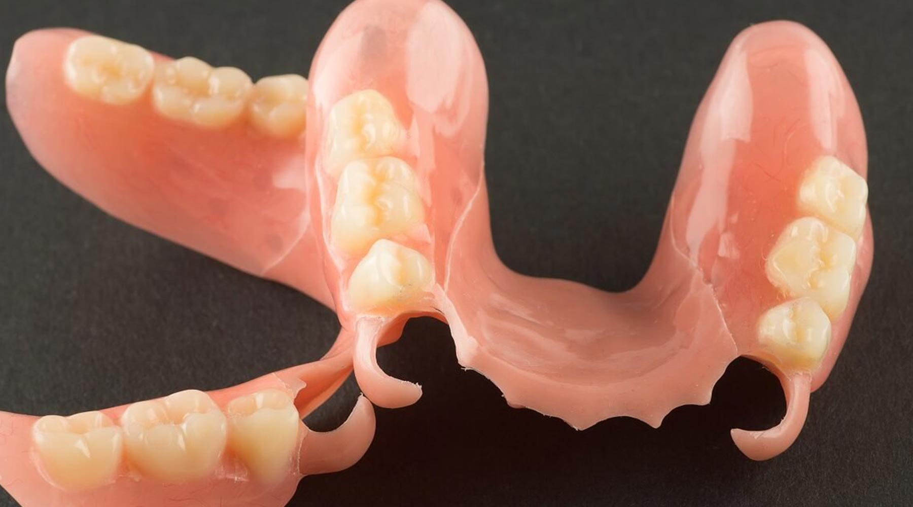 Why are Valplast dentures different?