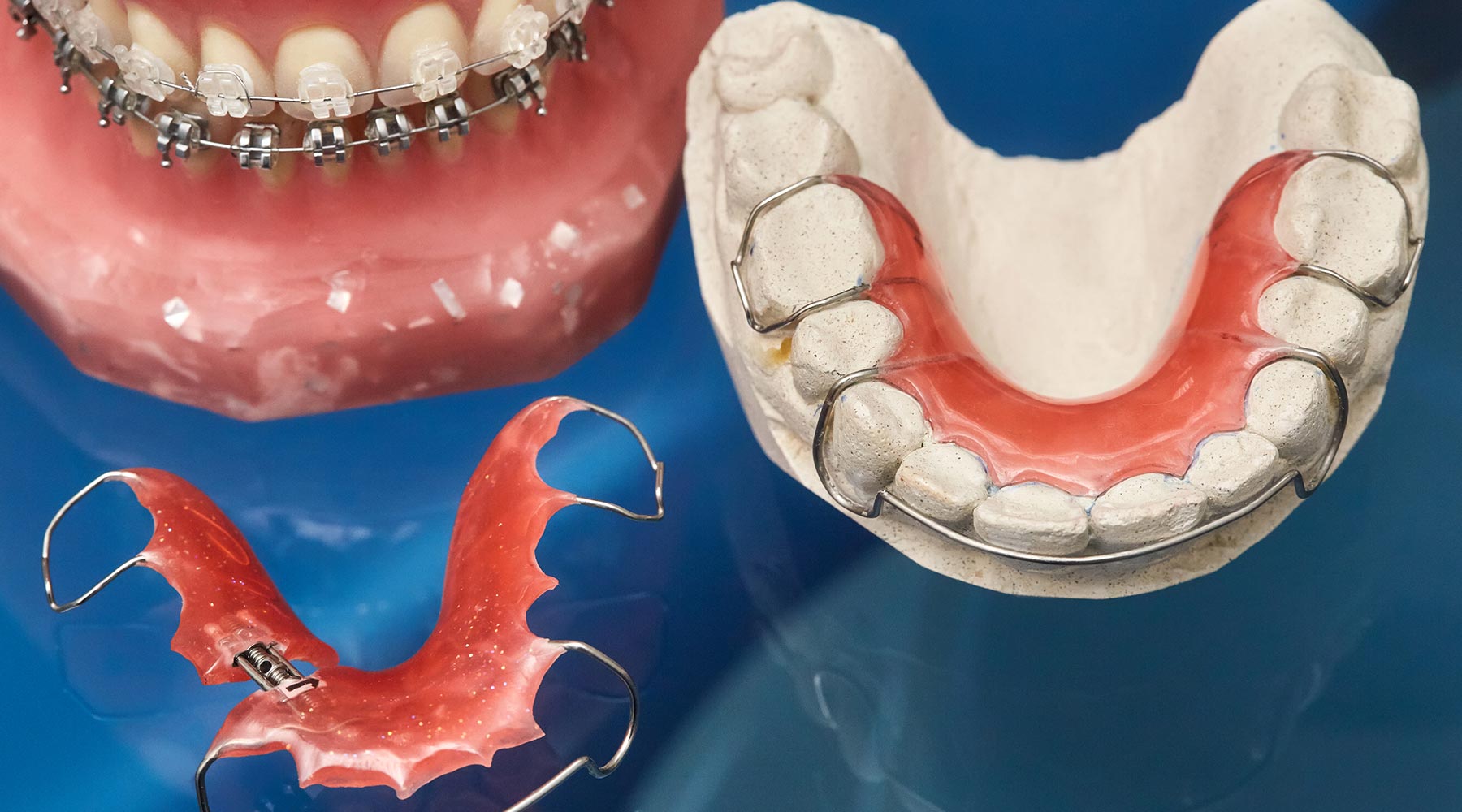 Can retainers straighten my teeth if they’ve relapsed?