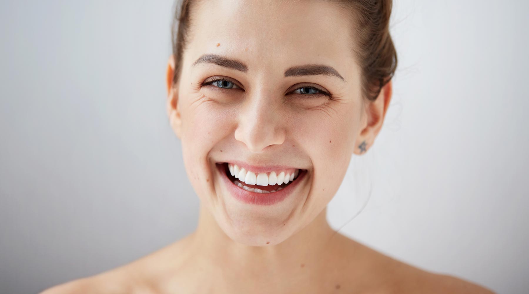 Creating your perfect smile with composite bonding